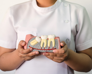 impacted wisdom tooth